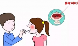 扁桃体炎发烧怎么办（扁桃体炎发烧怎么办怎样退烧快）