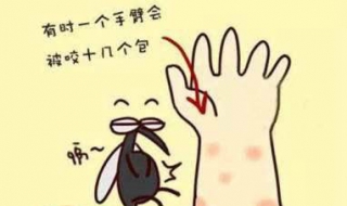 蚊子咬了怎么办 脸被蚊子咬了怎么办
