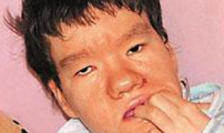 孩子智障怎么办 孩子智障怎么办残疾证