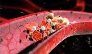 血粘度高怎么办（全切血粘度高怎么办）