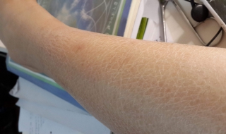 腿上皮肤干燥怎么办 腿上皮肤干燥怎么办小妙招