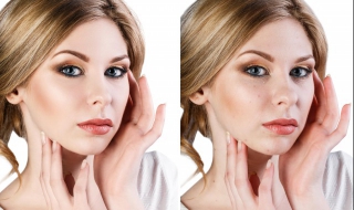 脸上长痘痘了怎么办 如果脸上长痘痘了怎么办