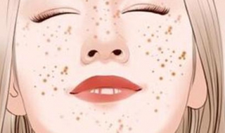 脸上长色斑该怎么办（脸上长色斑有什么办法）