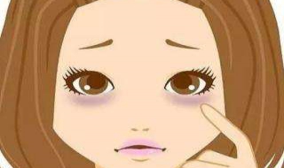 眼圈发黄怎么办 眼圈发黄怎么办