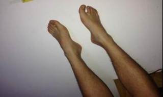 腿上有红血丝怎么办 腿上有红血丝怎么办,吃什么可以去掉