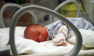 新生儿黄疸怎么办 为什么新生儿黄疸怎么办