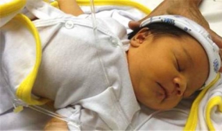 小儿黄疸怎么办 小儿黄疸怎么办?