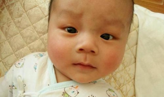 婴儿脸上湿疹怎么办 初生婴儿脸上湿疹怎么办