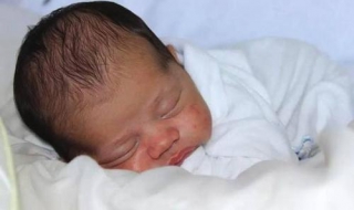 婴儿湿疹怎么办（婴儿湿疹怎么办好得快）