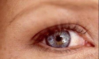 眼睛周围长斑怎么办（眼睛里面长斑怎么办）