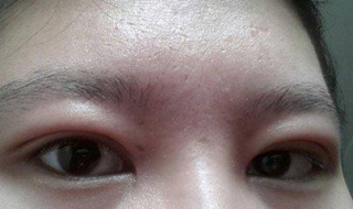 眼睛哭肿了怎么办（眼睛哭肿了怎么办消肿）