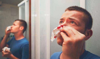 鼻子出血怎么办（鼻子出血怎么办教案及反思）