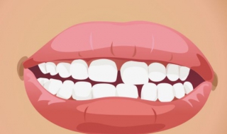 门牙有缝怎么办（八岁男孩门牙有缝怎么办）