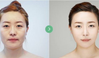 面部松弛怎么办（女人面部松弛怎么办）