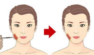 咬肌肥大怎么办 咬肌肥大怎么办怎么改善