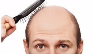 头发掉得很厉害怎么办（男生最近头发掉得很厉害怎么办）