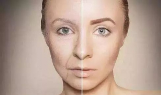 面部肤色不均怎么办（脸部皮肤肤色不均怎么办）