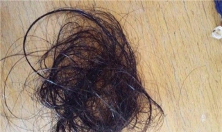 头发断的厉害怎么办 头发断的很厉害怎么办