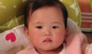 婴儿对眼怎么办 婴儿对眼怎么治疗方法