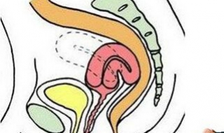 子宫后位怎么办 子宫后位怎么办啊调整