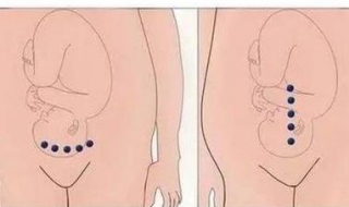 子宫壁薄怎么办（孕妇子宫壁薄怎么办）