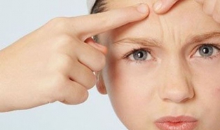 额头很多痘痘怎么办 额头有很多痘痘怎么办