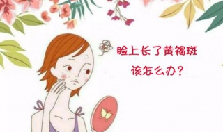 黄褐斑怎么办 皮肤长黄褐斑怎么办