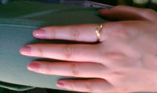 手上皮肤粗糙怎么办（手上皮肤粗糙怎么办图片）