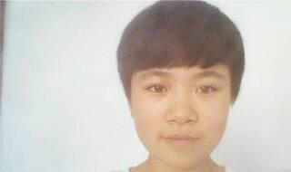 鼻头大怎么办（鼻翼宽鼻头大怎么办）