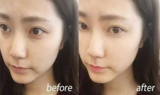 眼下有细纹怎么办（眼部有细纹了怎么办）