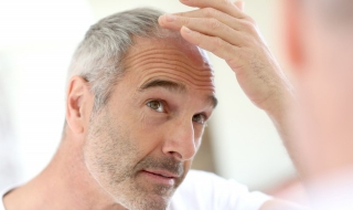 少年白发怎么办 少年白发怎么办?