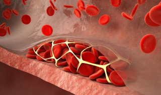 血脂稠怎么办 老人血脂稠怎么办