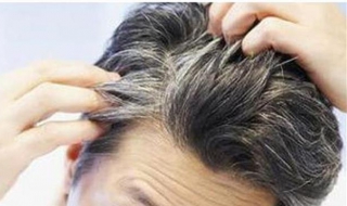 白发怎么办 40岁长了很多白发怎么办