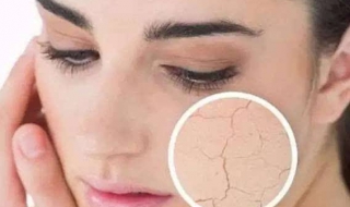 皮肤粗糙脱皮怎么办 皮肤粗糙脱皮怎么办小妙招