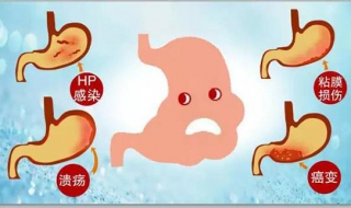 得了慢性胃炎怎么办（得了慢性胃炎怎么办,能治好吗）