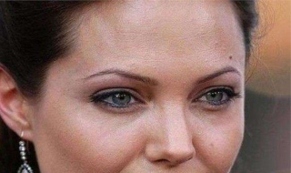 额头皮肤粗糙怎么办（额头的皮肤粗糙是怎么回事）