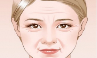 额头皱纹怎么办 40多岁额头皱纹怎么办