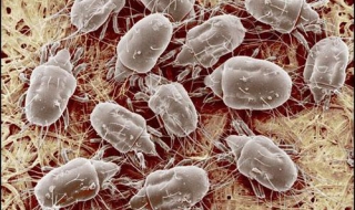 尘螨过敏怎么办（对空气中的尘螨过敏怎么办）