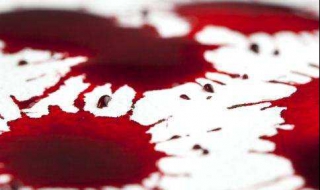 痔疮流血怎么办 痔疮流血但是不疼是怎么回事