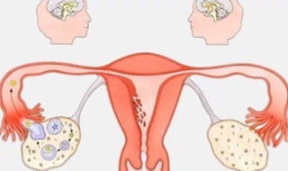 白带多怎么办 如果女生的分泌物过多怎么办