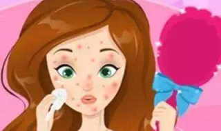 面部长了痤疮怎么办 脸部长了痤疮怎么办