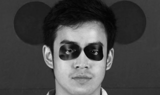 黑眼圈重怎么办 眼袋大黑眼圈重怎么办