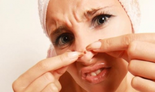 鼻子上有黑头怎么办（女孩鼻子上有黑头怎么办）