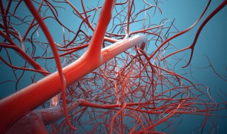 如何远离动脉阻塞 动脉堵塞怎么办