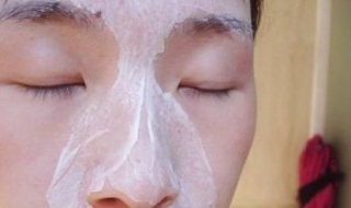 鼻子有黑头怎么去除 鼻子有黑头怎么去除图片