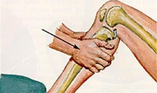 前交叉韧带断裂怎么复建 前交叉韧带重建后悔死了