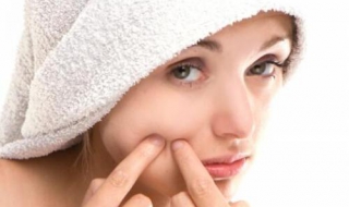 如何去痘印 如何去痘印最快