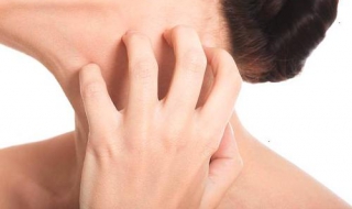 湿疹怎么治 湿疹怎么治疗好得最快最有效