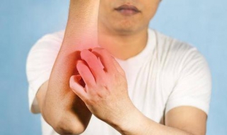 湿疹怎么引起的 湿疹怎么引起的原因