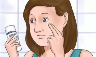 如何去痘印（如何去痘印疤学生）